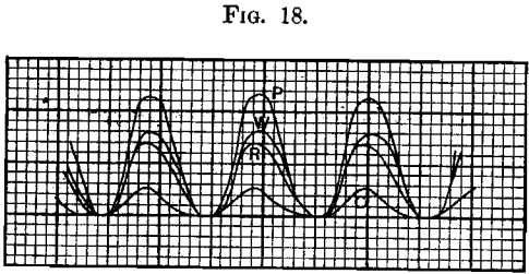 area-of-plunger