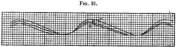 size-of-grain