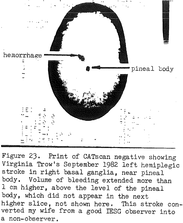 inductive-electrostatic-gradiometry catscan